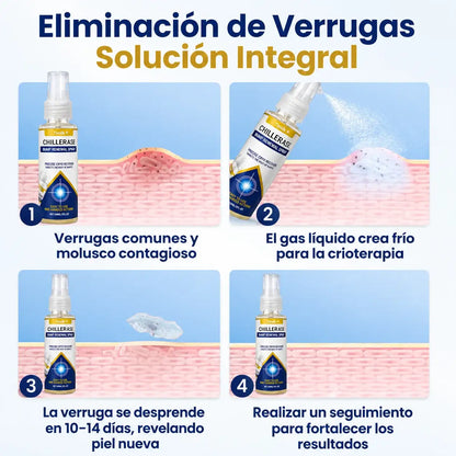 ChillErase Spray de Verrugas